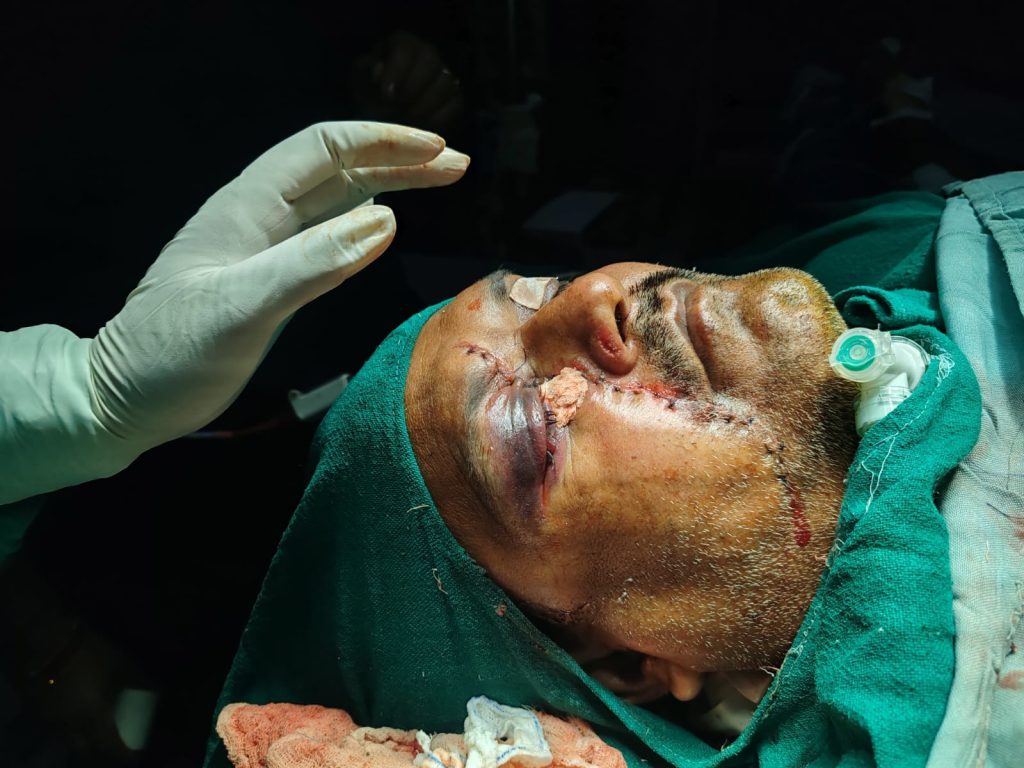 A mason in India survives a freak accident as a flying machine blade slices through his face. Discover the miraculous surgery and incredible fight to save his sight!