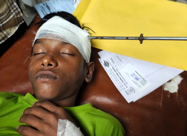 A 14-year-old boy in India miraculously survived after a metal rod pierced his skull. Life-saving surgery removed it with precision, leaving doctors stunned by his recovery.