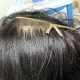 A woman in China had a claw clip embedded in her scalp after being hit by a car. Doctors removed it in 10 minutes, warning of the hidden dangers of hair accessories.