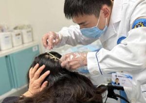 A woman in China had a claw clip embedded in her scalp after being hit by a car. Doctors removed it in 10 minutes, warning of the hidden dangers of hair accessories.